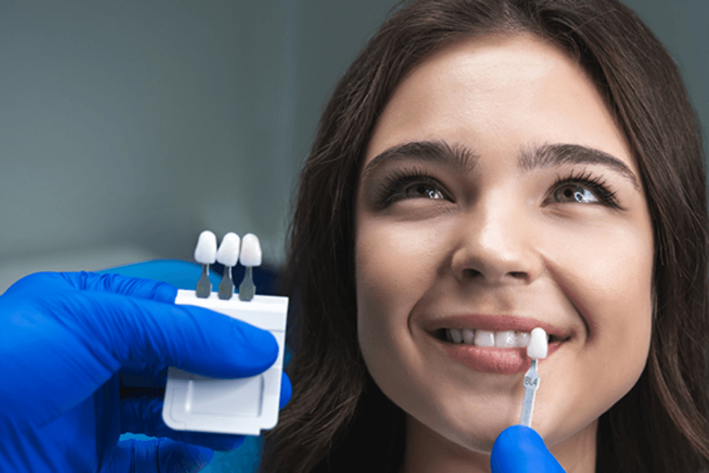 same-day-crown-colour-matching