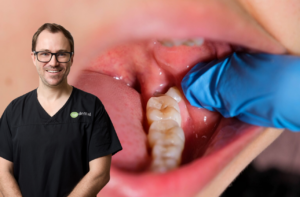 Dentist examining a patient's mouth during a wisdom teeth check-up
