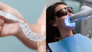 Patient wearing protective glasses during in-chair teeth whitening treatment